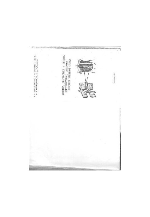Clinic, diagnostics and treatment of vertebrogenic abdominal wall syndrome