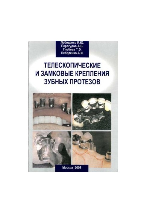 Telescopic and locking attachments of dentures
