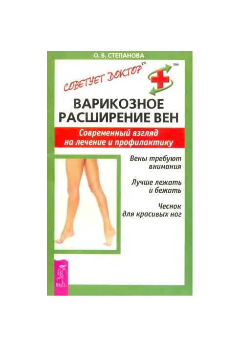 Varicose veins.