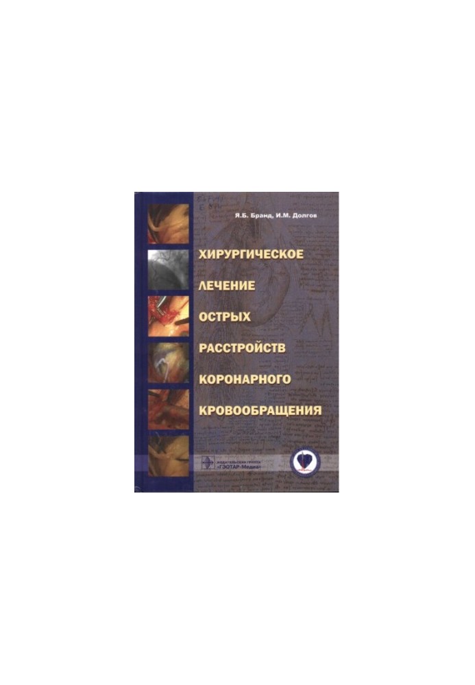 Surgical treatment of acute coronary circulatory disorders: [guide for doctors]