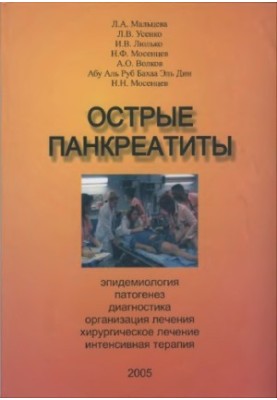 Острый панкреатит