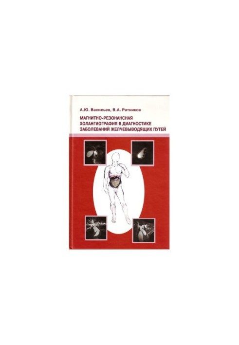 Magnetic resonance cholangiography in the diagnosis of diseases of the biliary tract