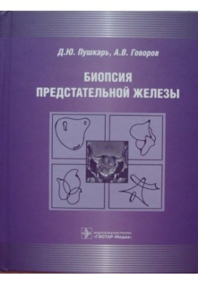 Prostate biopsy