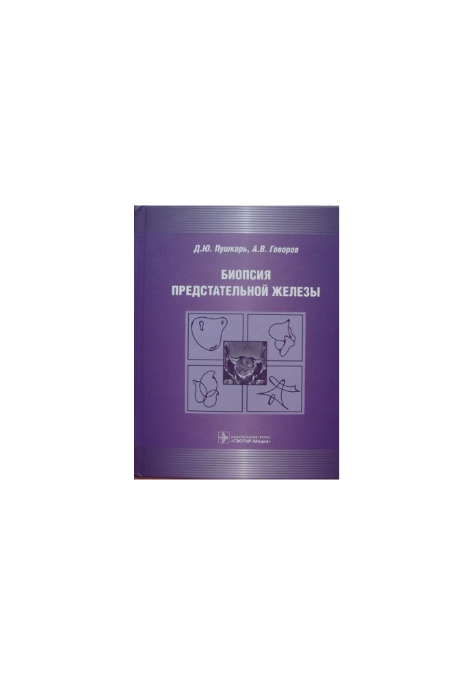 Prostate biopsy