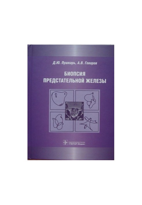 Prostate biopsy