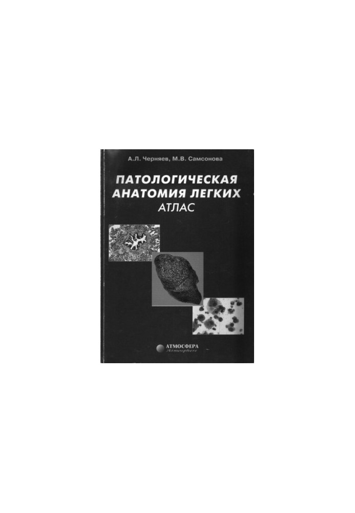 Патологическая анатомия легких: Атлас