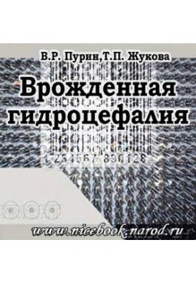 Вроджена гідроцефалія