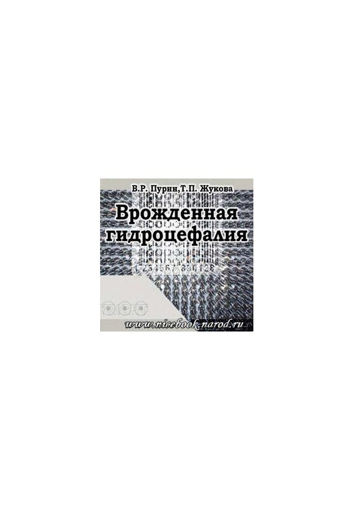 Вроджена гідроцефалія