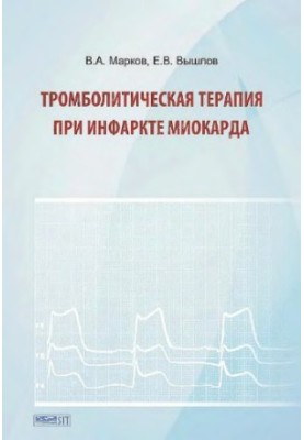Тромболитическая терапия при инфаркте миокарда Trombolitic therapy at myocardium infarction : [монография : электронное издан