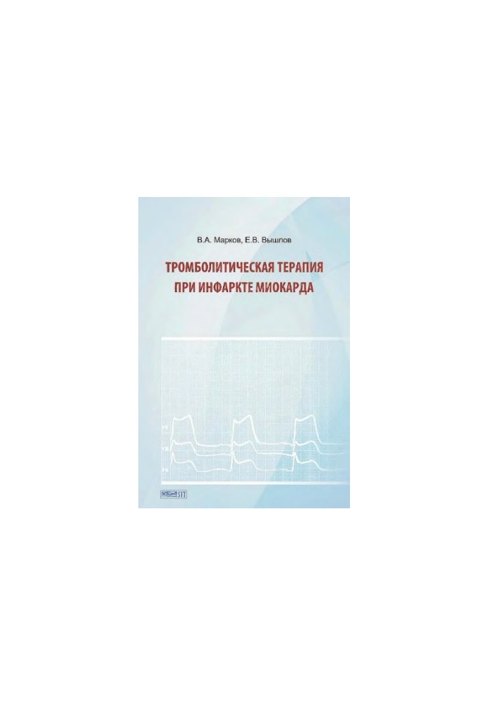 Тромболитическая терапия при инфаркте миокарда Trombolitic therapy at myocardium infarction : [монография : электронное издан