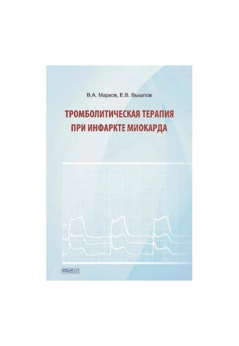 Тромболитическая терапия при инфаркте миокарда Trombolitic therapy at myocardium infarction : [монография : электронное издан