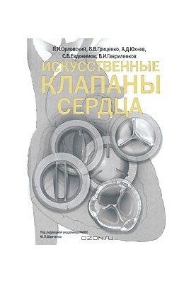 Штучні серцеві клапани