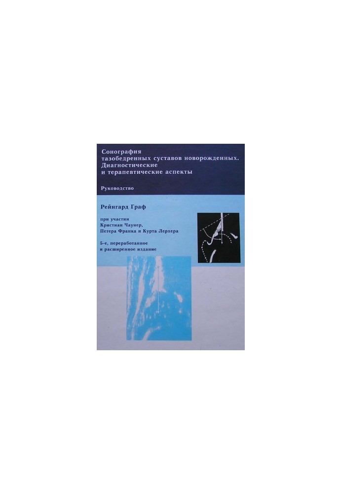 Sonography of the hip joints of newborns. Diagnostic and therapeutic aspects of the manual. - 5th ed., rework.