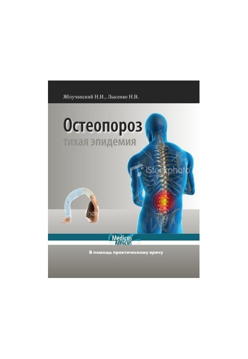 Osteoporosis. To help a practical doctor.