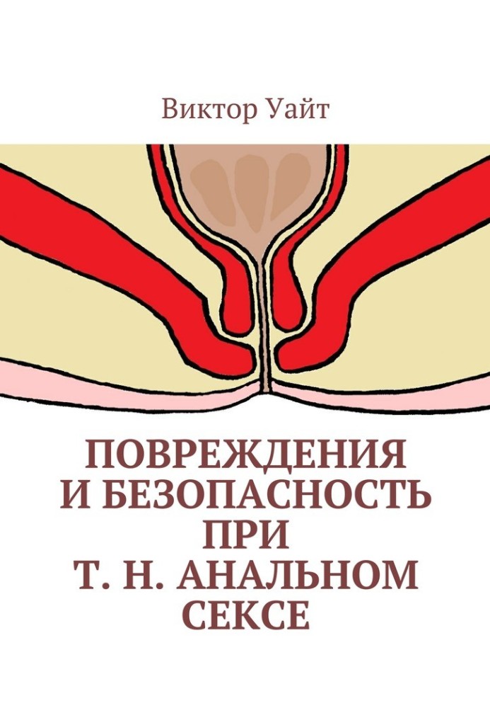 Ушкодження та безпека при т.з. анальному сексі