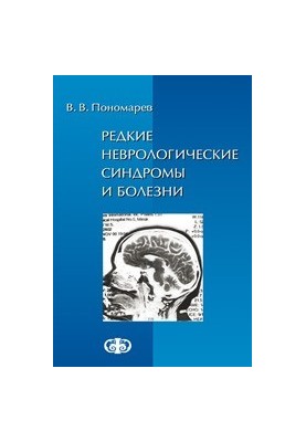 Rare neurological syndromes and diseases