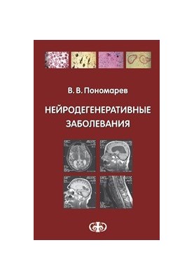 Нейродегенеративные заболевания: Руководство для врачей