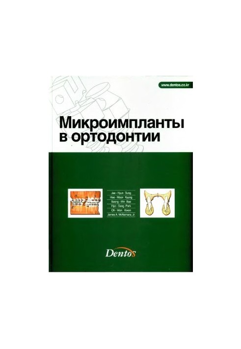 Microimplants in orthodontics
