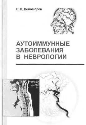 Autoimmune diseases in neurology
