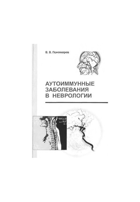 Autoimmune diseases in neurology