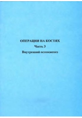 Операции на костях
