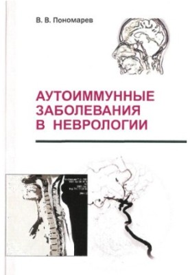 Аутоимунные заболевания в неврологии.