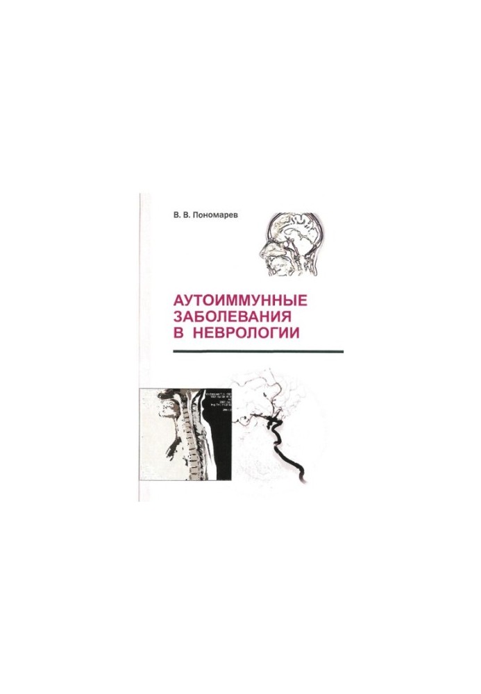 Аутоимунные заболевания в неврологии.