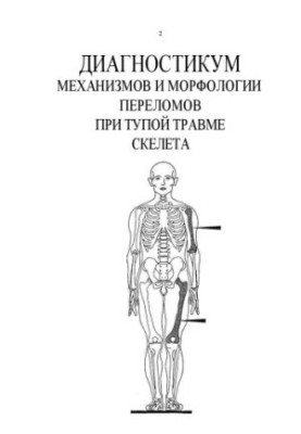 Diagnostics of mechanisms and morphology of fractures in blunt skeletal injury. Volume 1