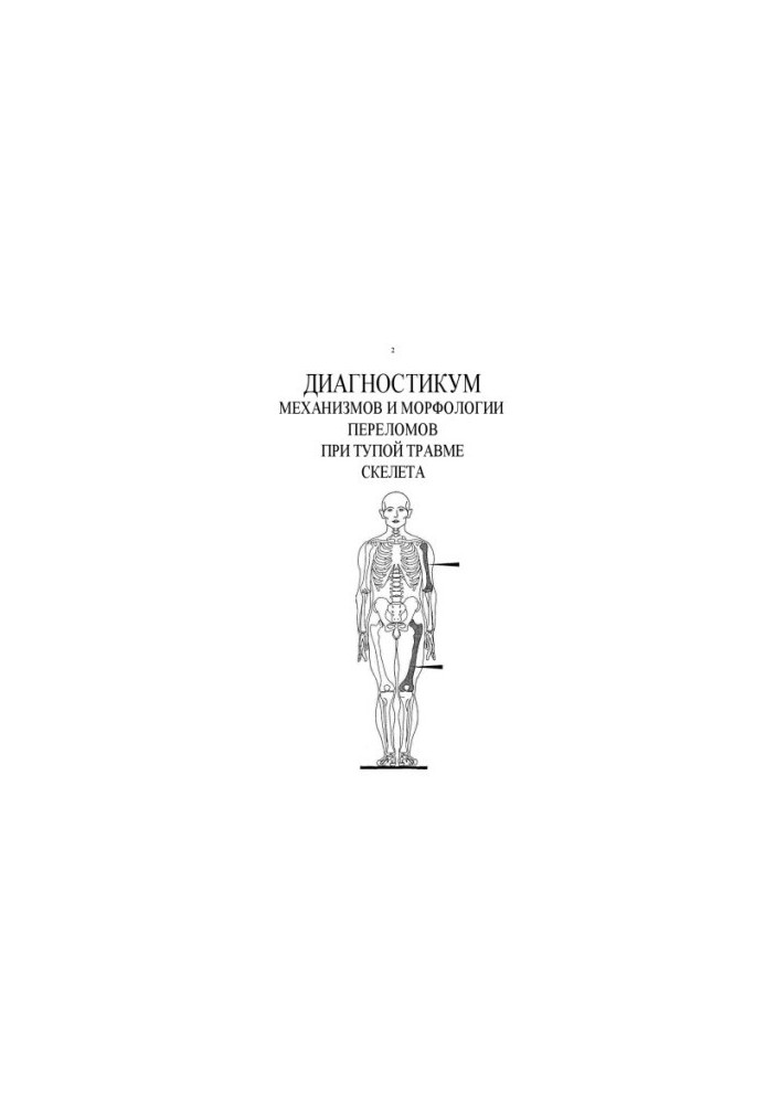 Diagnostics of mechanisms and morphology of fractures in blunt skeletal injury. Volume 1