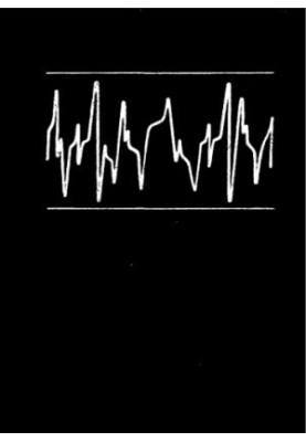 Vibroacoustic diagnostics and reduction of vibroactivity of ship mechanisms