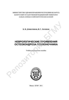 Неврологічні прояви остеохондрозу хребта