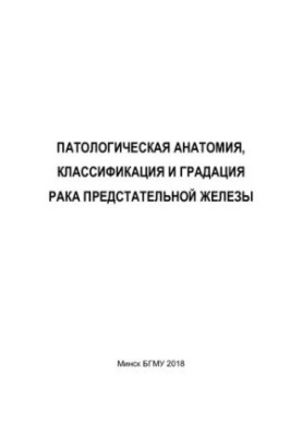 Pathological anatomy, classification and gradation of prostate cancer
