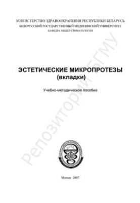 Эстетические микропротезы (вкладки)