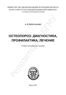 Остеопороз: діагностика, профілактика, лікування