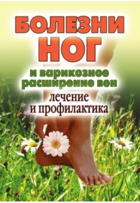 Leg diseases and varicose veins. Treatment and prevention