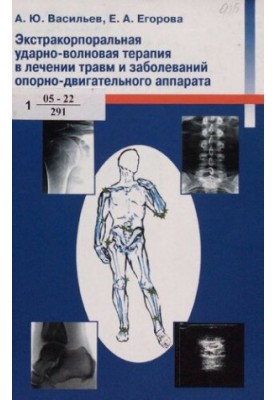 Экстракорпоральная ударно-волновая терапия в лечении травм и заболеваний опорно-двигательного аппарата