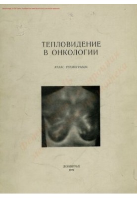 Теплове зображення в онкології. Тепловізійний метод дослідження в онкологічній практиці