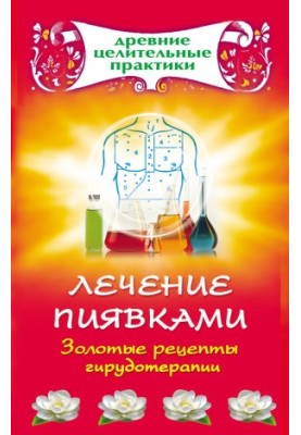 Лікування п’явками. Золоті рецепти гирудотерапії