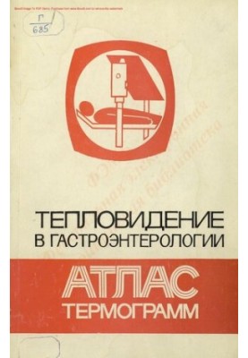 Тепловизионный метод исследования в гастроэнтерологии