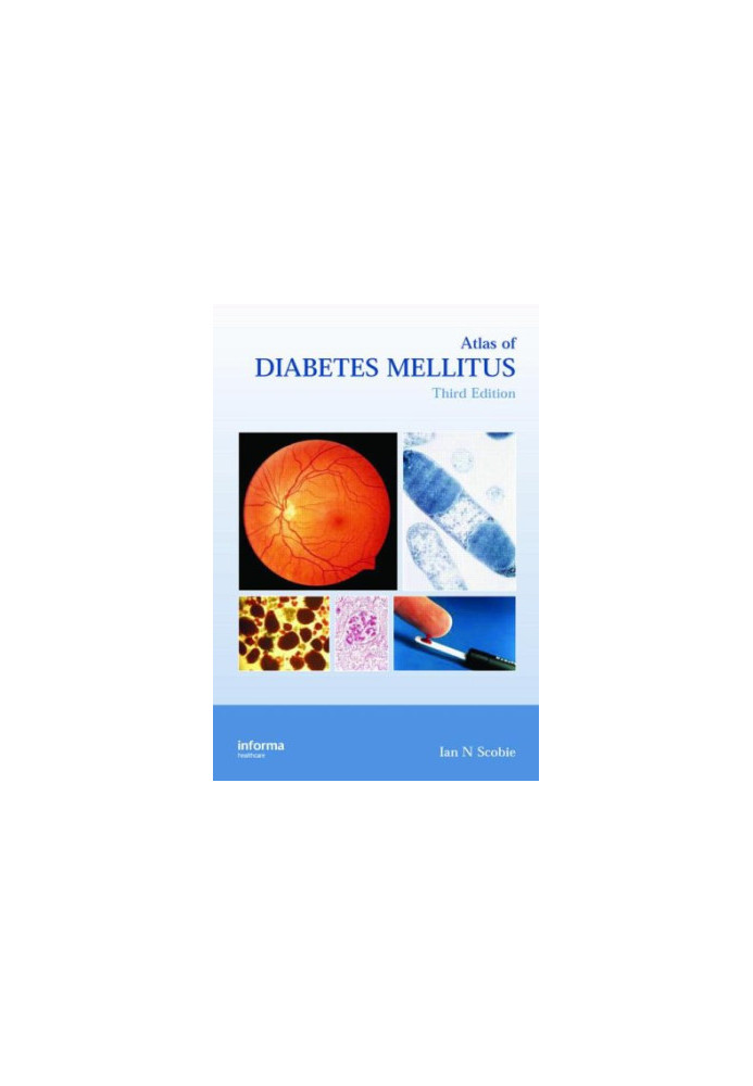Atlas of Diabetes Mellitus, Third Edition (Encyclopedia of Visual Medicine)