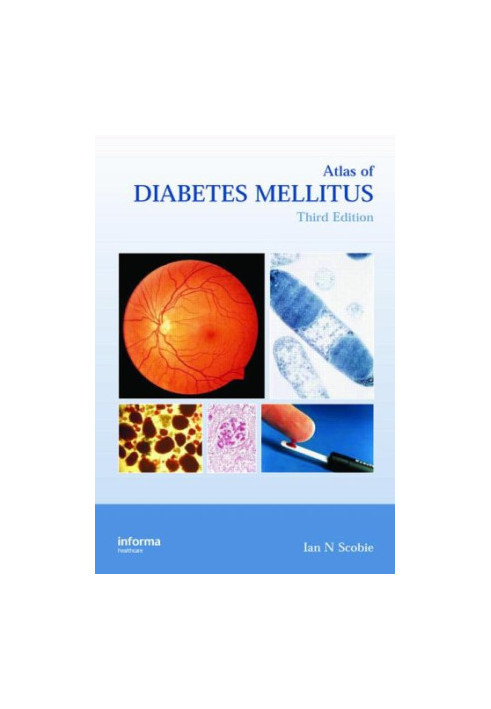 Atlas of Diabetes Mellitus, Third Edition (Encyclopedia of Visual Medicine)