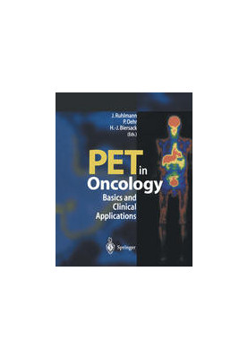 PET in Oncology: Basics and Clinical Application