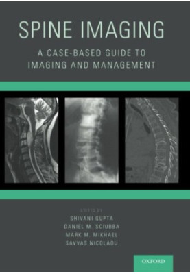Spine imaging : a case-based guide to imaging and management