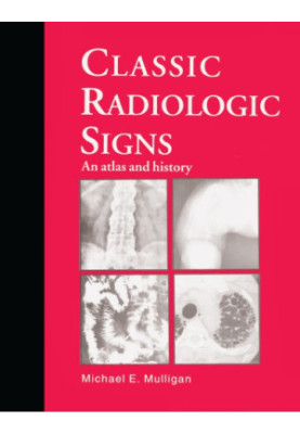 Classic radiologic signs an atlas and history
