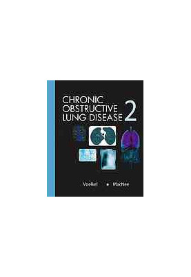 Chronic obstructive lung diseases 2