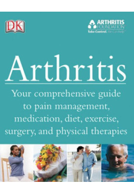 Arthritis