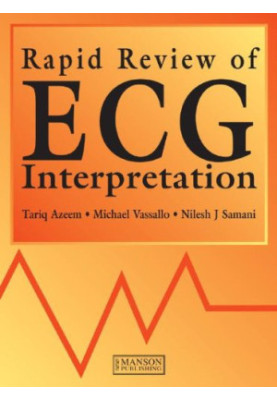 Rapid Review of ECG Interpretation