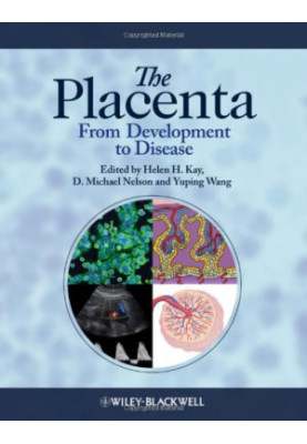 The Placenta: From Development to Disease