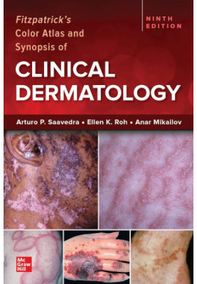 Fitzpatrick's Color Atlas and Synopsis of Clinical Dermatology, Ninth Edition