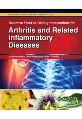 Bioactive food as dietary interventions for arthritis and related inflammatory diseases